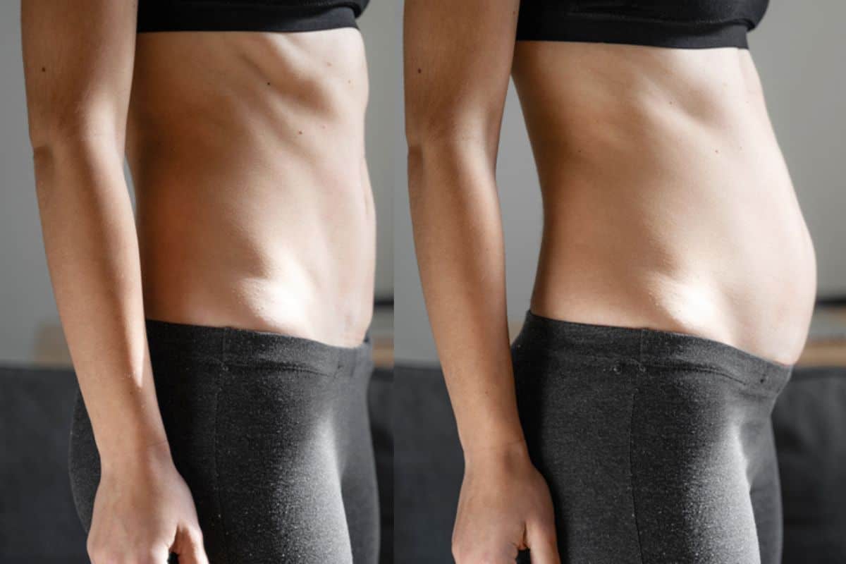 How long does diastasis recti take to improve Greater Manchester?