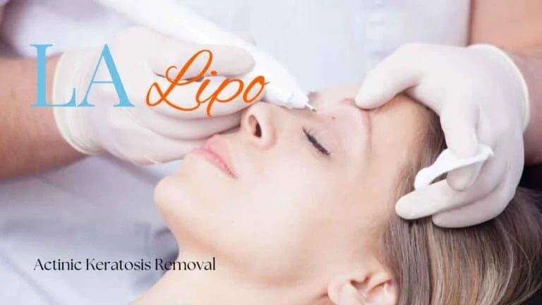 Woman receiving Actinic Keratosis Removal Treatment Greater Manchester