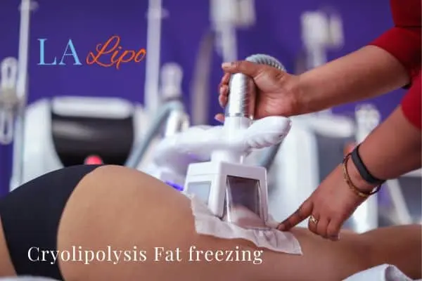 women getting fat freezing Greater Manchester