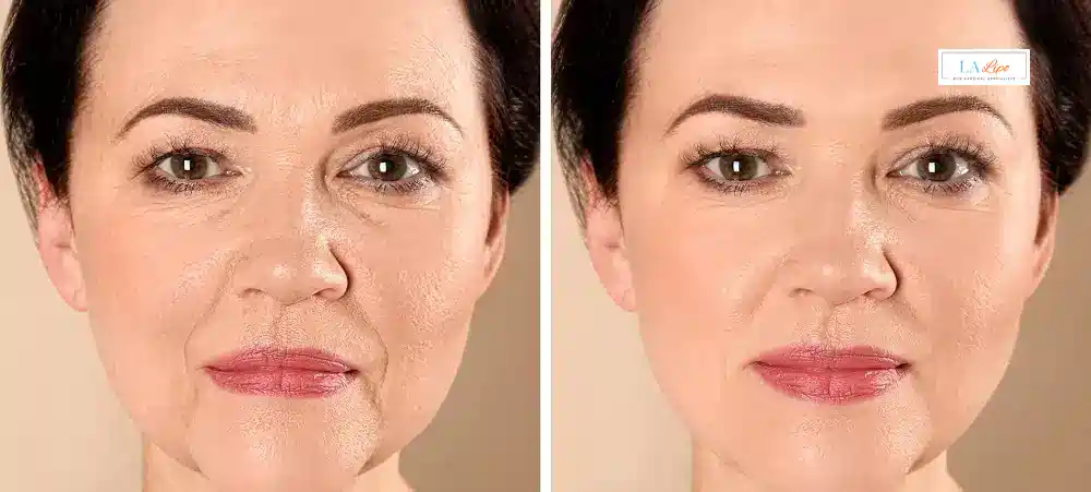 How Long Does It Take to See Results and How Long Do They Last Greater Manchester?