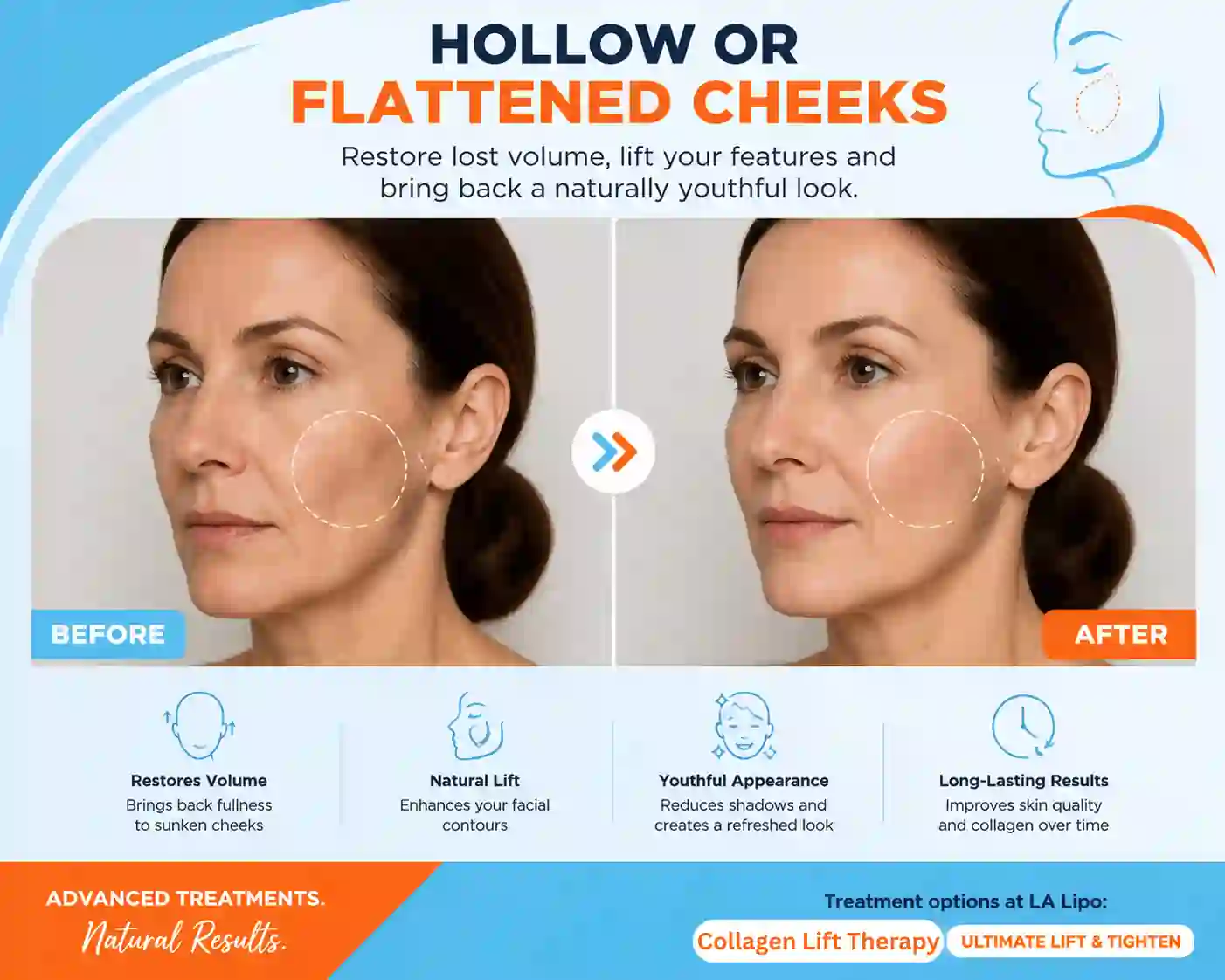 Sign #4: Hollow or Flattened Cheeks Greater Manchester