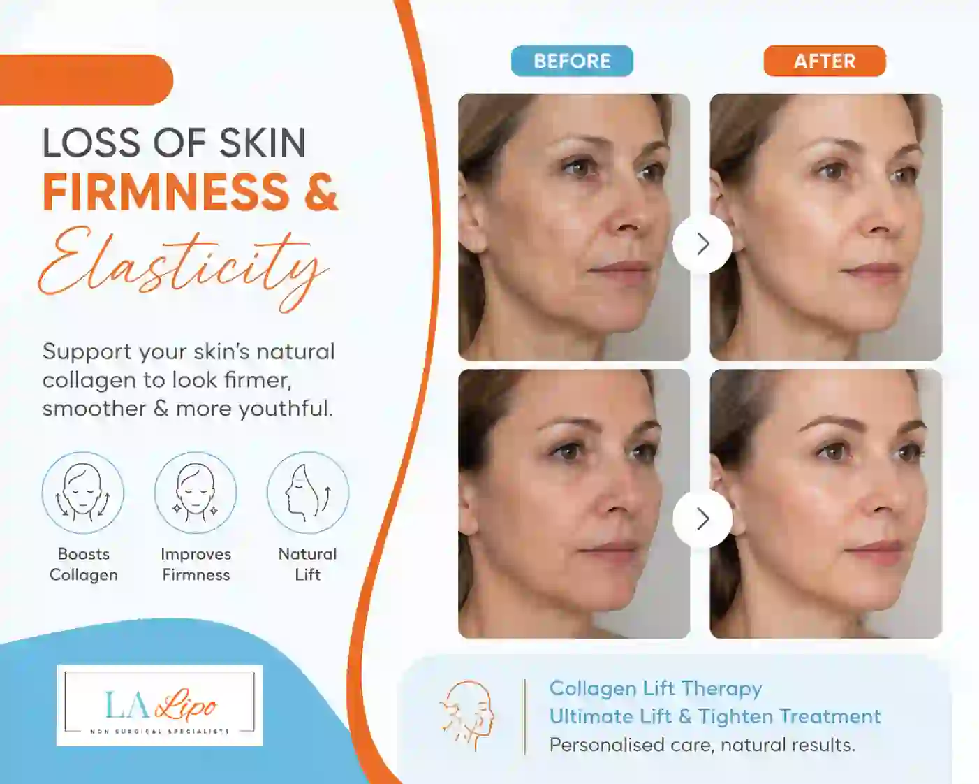 Sign #7: Loss of Skin Firmness and Elasticity Greater Manchester